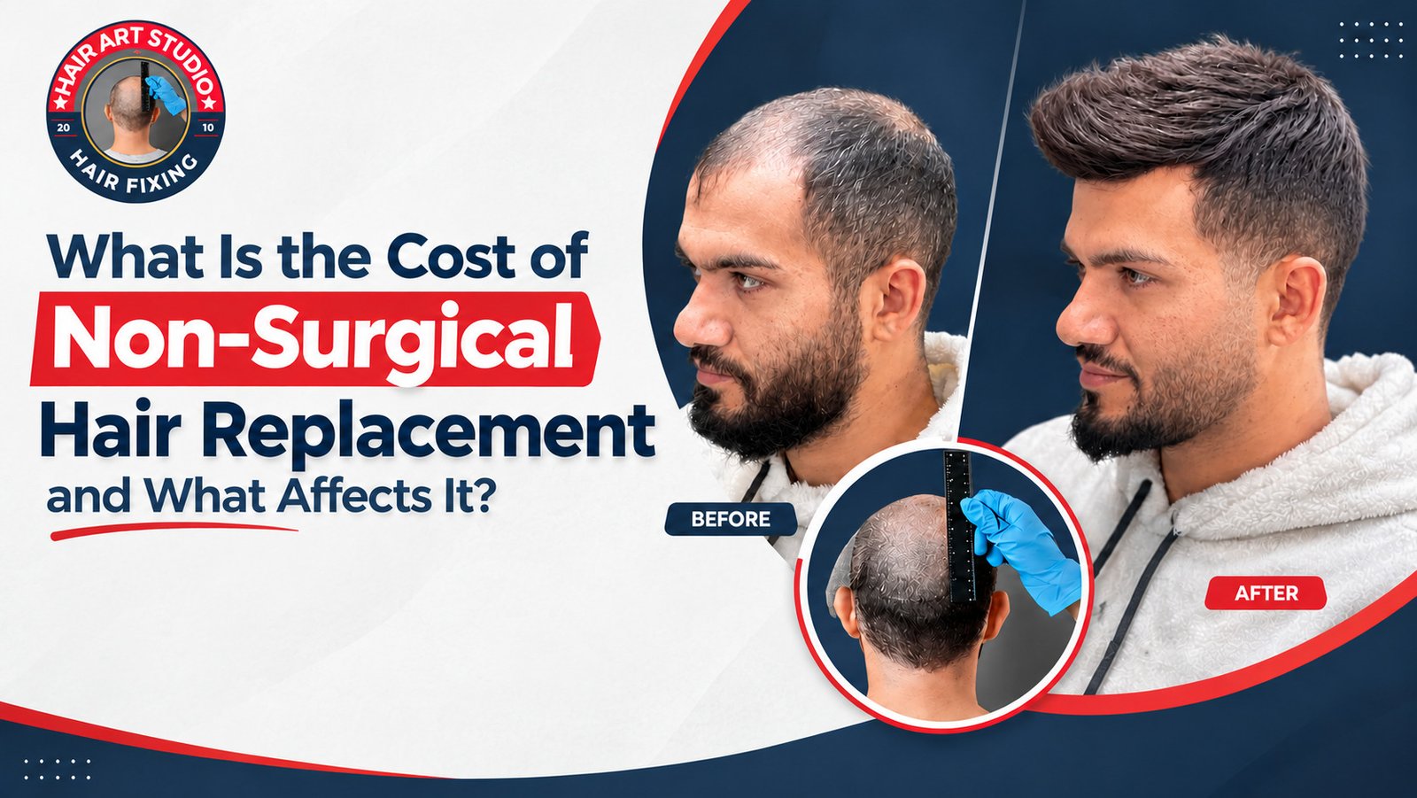 What Is the Cost of Non-Surgical Hair Replacement and What Affects It?