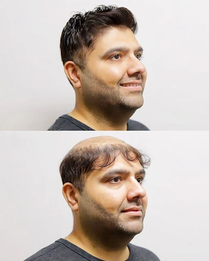 Hair Patch
